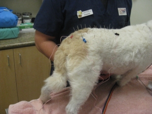 Acupuncture Treatment