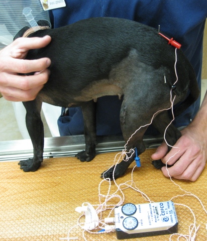 Acupuncture Treatment