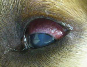Glaucoma