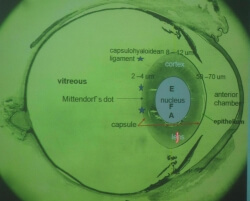 Progressive Retinal Atrophy 