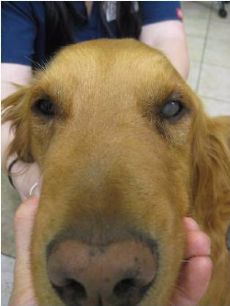 Intraocular Prostheses