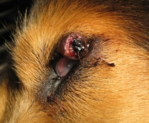 Eyelid Mass