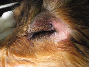 Eyelid Mass