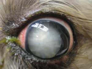 Cataract 