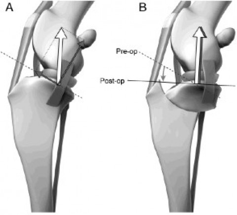 diagram of leg