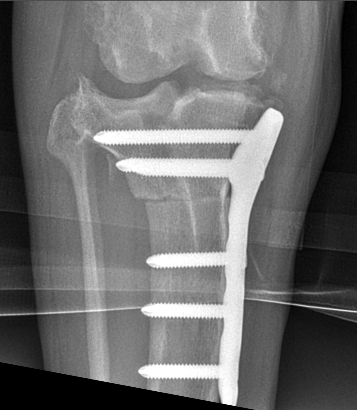 X-ray Image